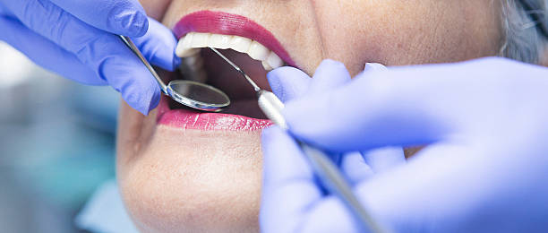 Best Knocked-Out Tooth (Avulsed Tooth) Treatment in Pilot Mountain, NC